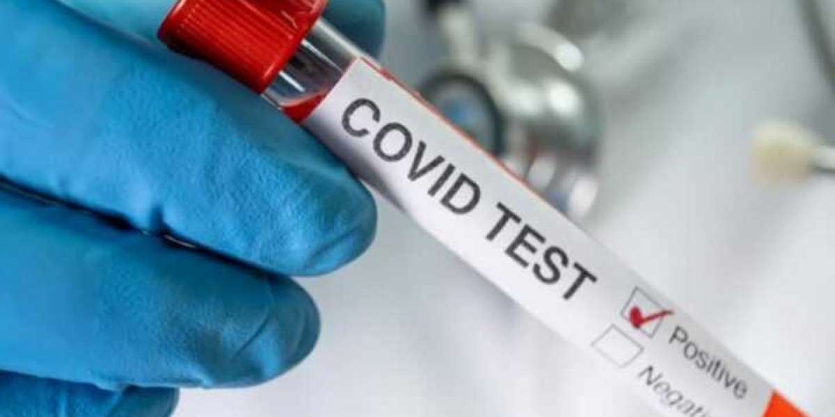 Cost of covid antibody test