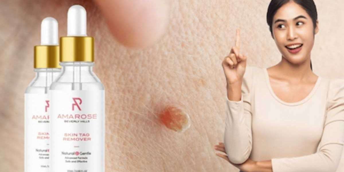 Amarose Skin Tag Remover (#1 PREMIUM WEIGHT LOSS FORMULA) Shocking Result