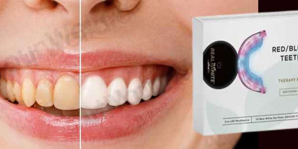 Natural Teeth Whitener Review - Brighten Your Smile
