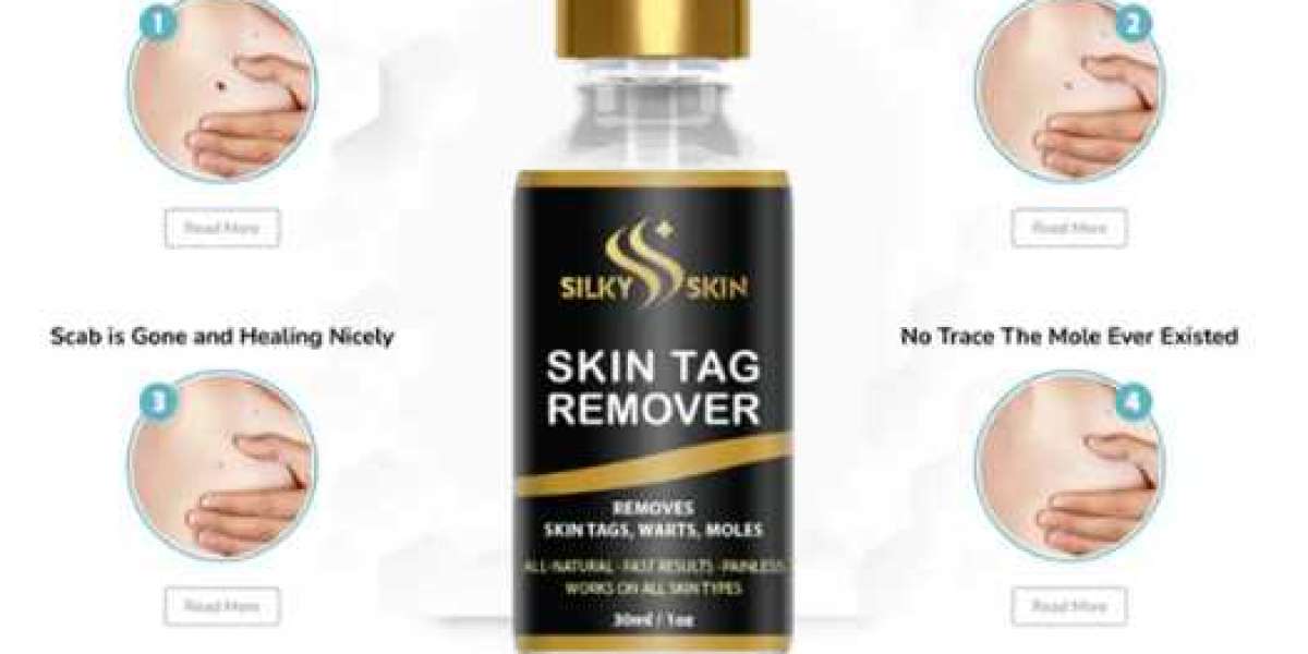 Silky Skin Tag Remover Review [New Update] Price, Where to Buy