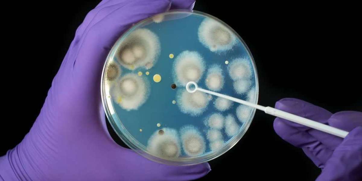 Global Pseudomonas Aeruginosa Treatment Market Share & Upcoming Industry Growth | Report Covers Industry Insights on