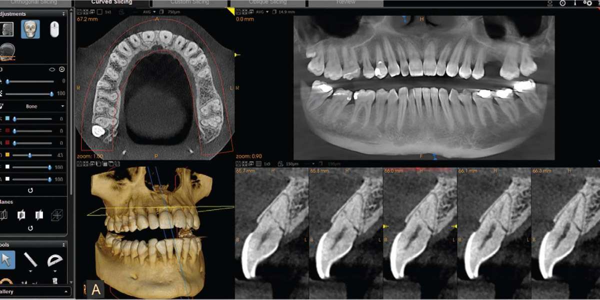 CBCT Dental Imaging Market Share Thrives Due to Introduction of New Technologies