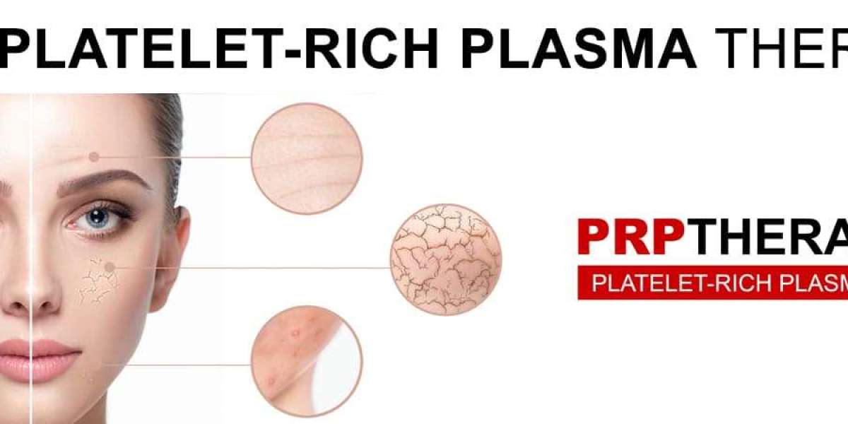 prp skin treatment