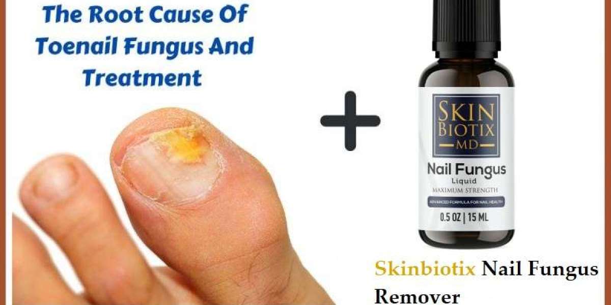 SkinBioTix Nail Fungus Remover [Critical Report] – Is It Hoax Or Legit?