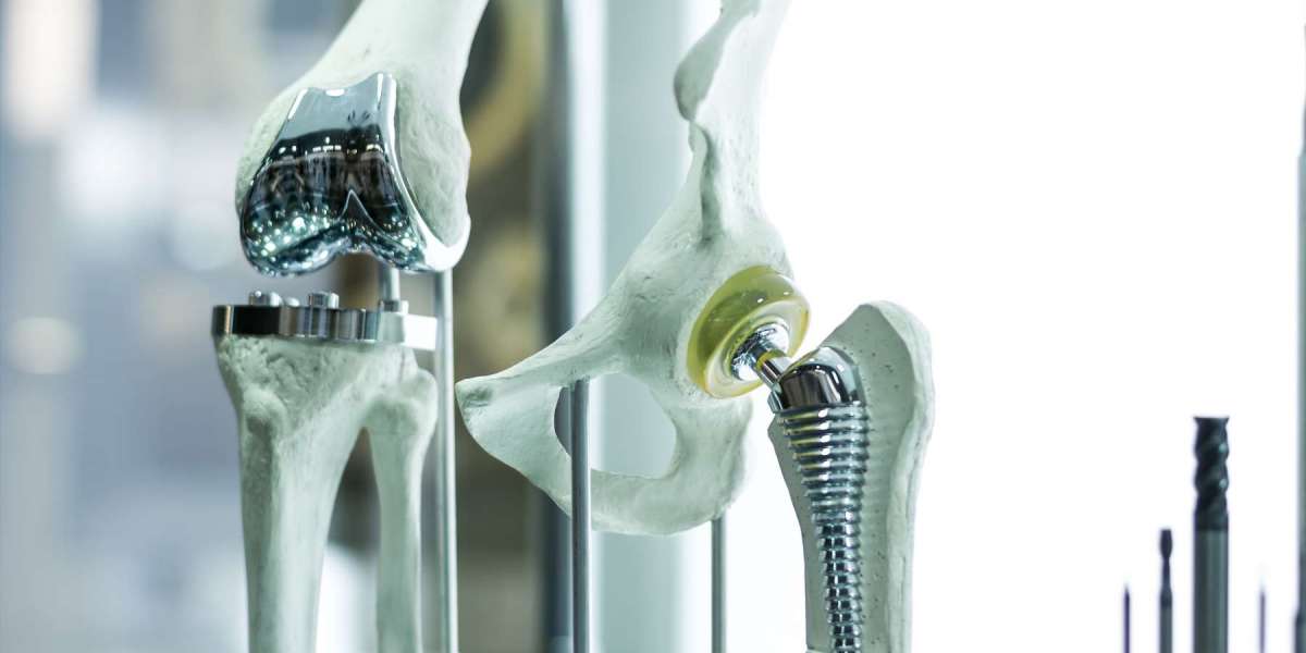 A Modification In Treatment Methodology Will Maintain The Americas Orthopedic Biomaterial Market Share