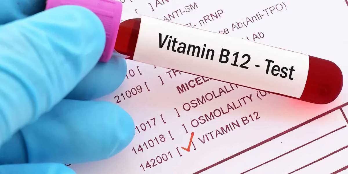 Active B12 Test Market Share to Witness Steady Rise in the Coming Decade