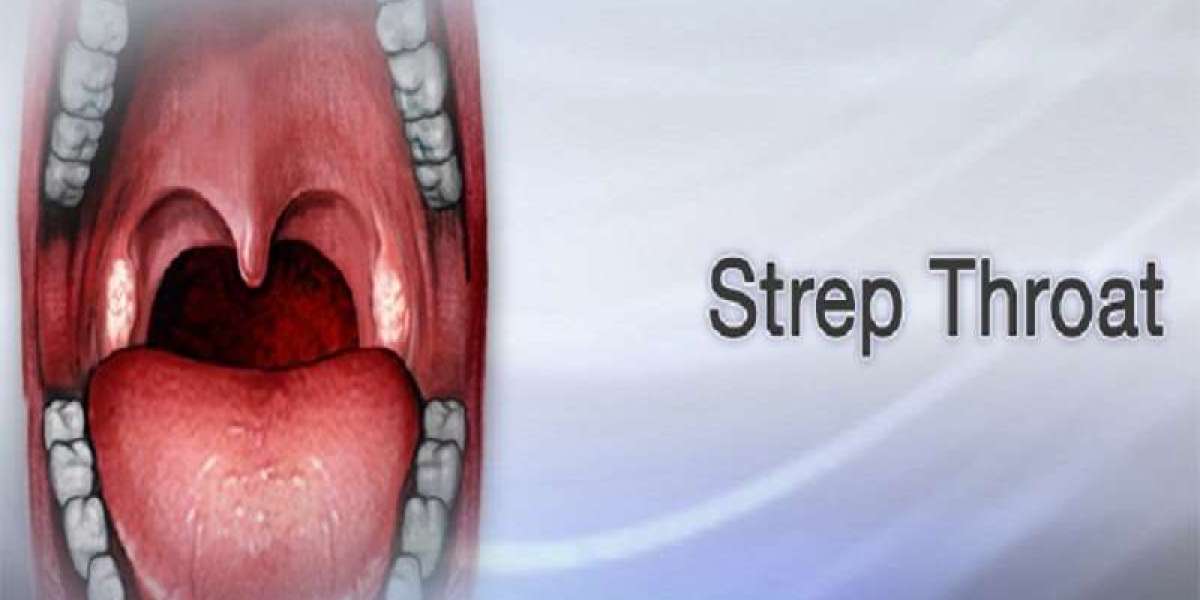 The Incredible Impact of Strep Throat Without Tonsils