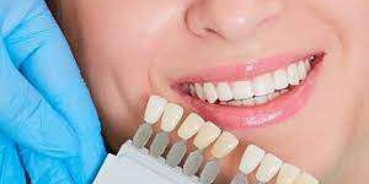 What Should You Choose Between Invisalign Or Metal Braces In Houston?