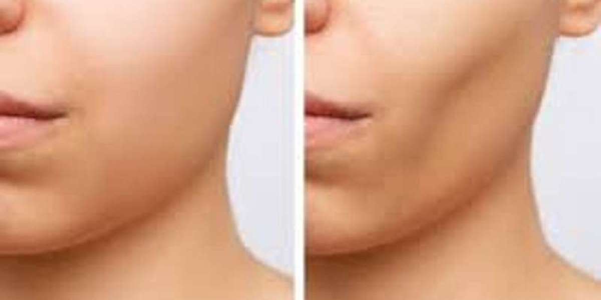 What Are The Best Cosmetic Procedures To Acquire The Best Shape?