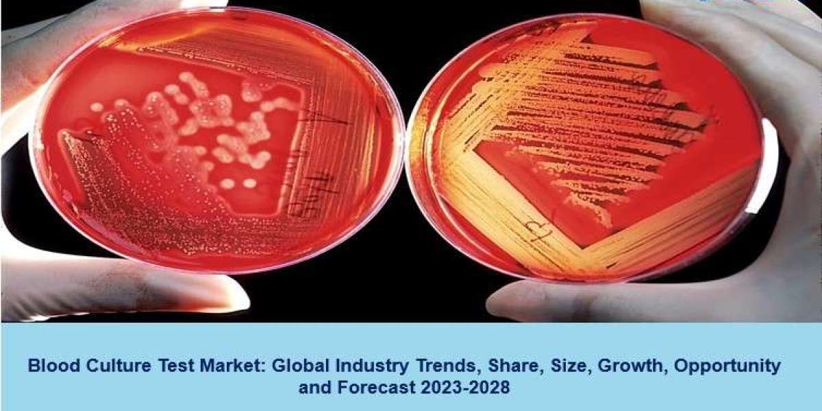 Blood Culture Test Market Size, Trends, Demand, Industry Growth And Analysis 2023-2028