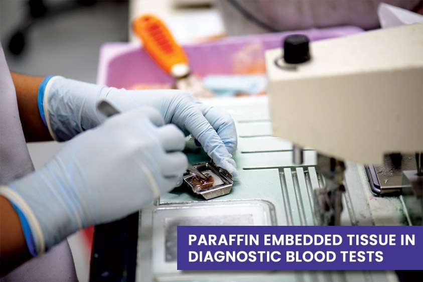 Paraffin Embedded Tissue