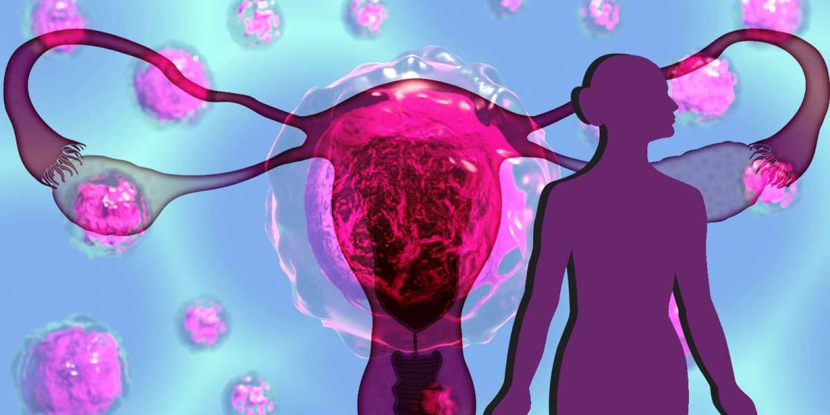 Ovarian Cysts Market Share Multiply Relentlessly; Asserts MRFR Unleashing Industry Forecast Up To 2032