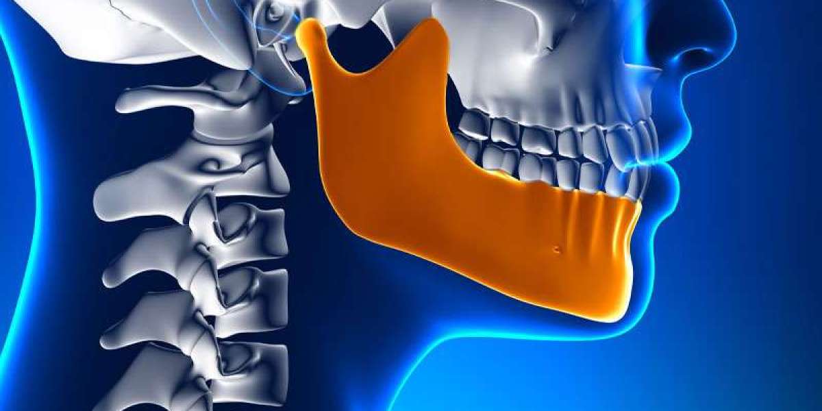 Global TMJ Implants Market Share & Upcoming Industry Growth | Report Covers Industry Insights on Regional Competitio