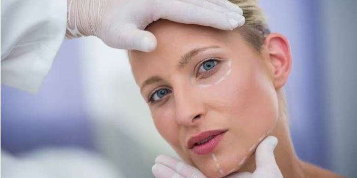 Facelift: Rejuvenate Your Youthful Appearance
