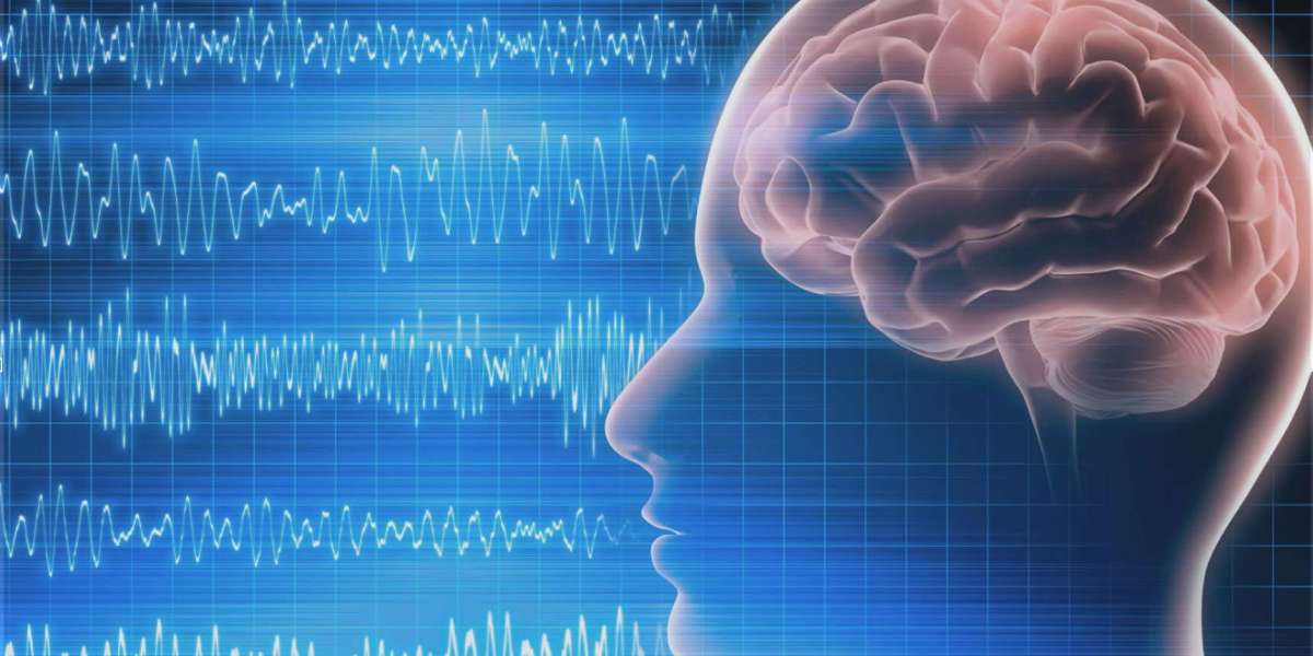 Neurodiagnostics Market Share To Be Enhanced By Enhancement of Distribution Chains Associated with Pharmaceutical Drugs