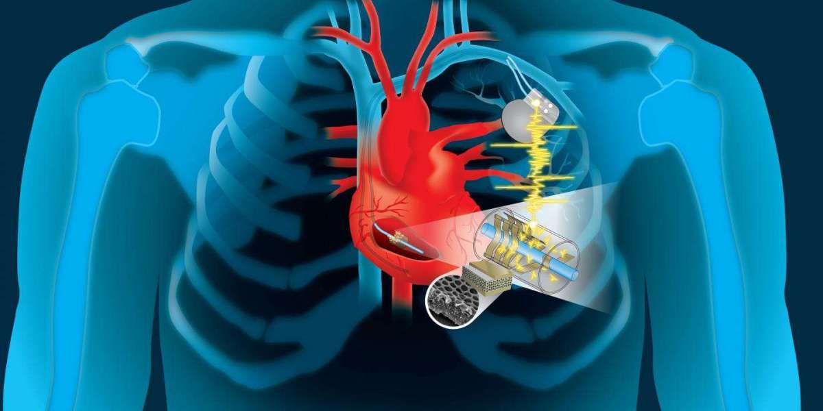 Cardiac Implants Market Share to Cross USD 24.83 Billion Valuation by 2030