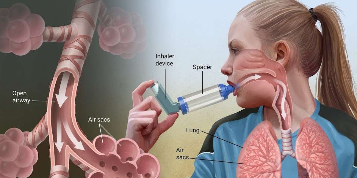 Asthma Inhaler Device Market Share on Upcoming Growth of the Industry