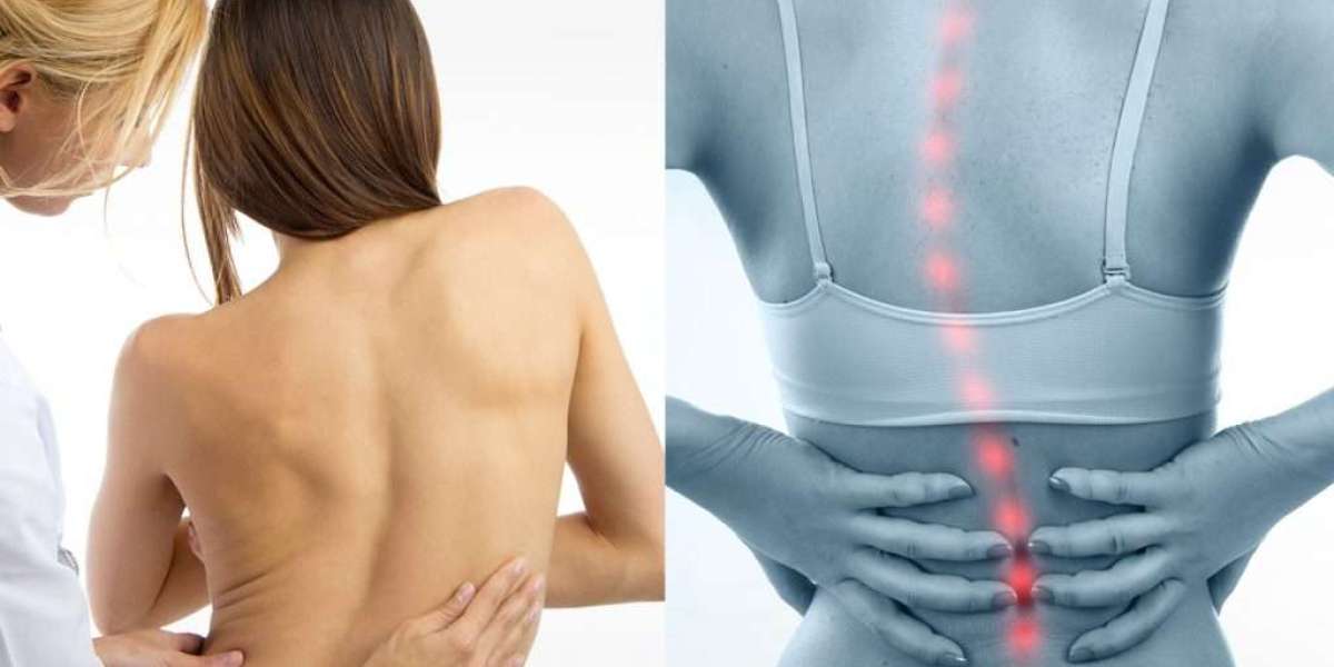 Scoliosis Specialists in Malaysia