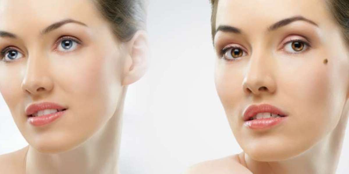 Derm La Fleur Anti Aging Serum – Reduces all skin problems in a natural manner!