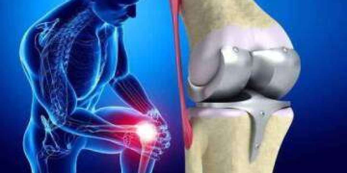 Orthopedic Biomaterial Market Research Report Analysis and Forecast till 2028