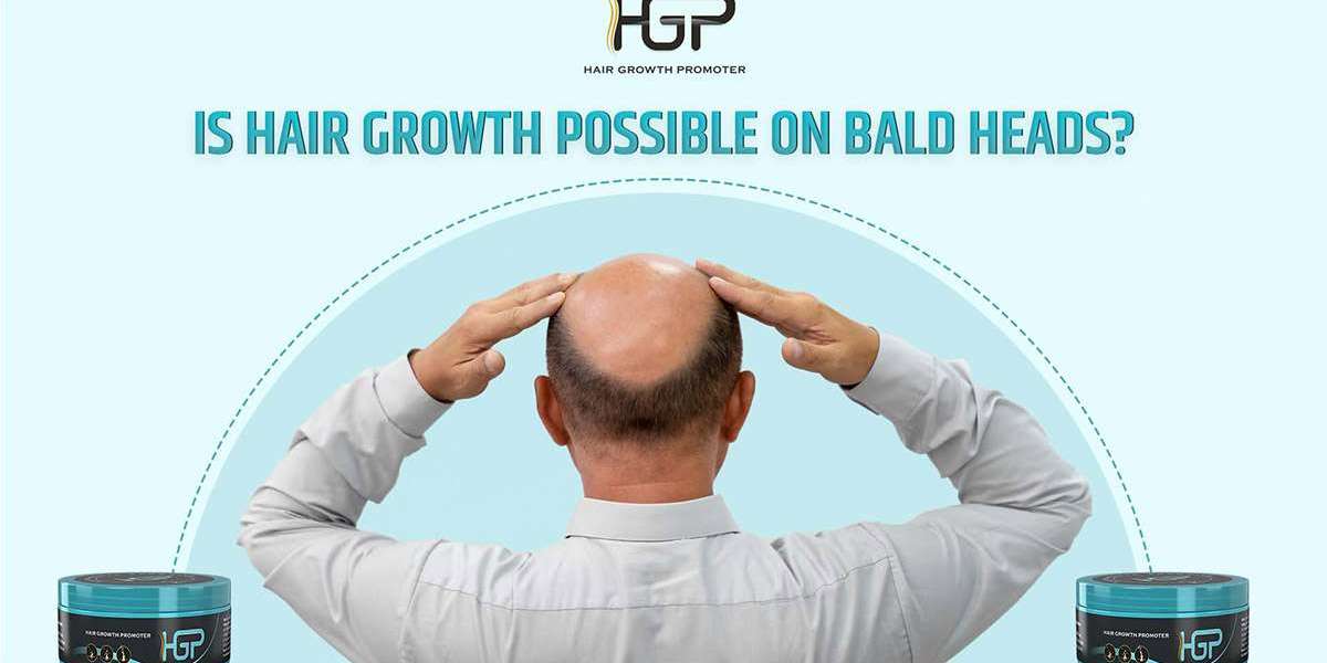 Is Hair Growth Possible on Bald Heads?