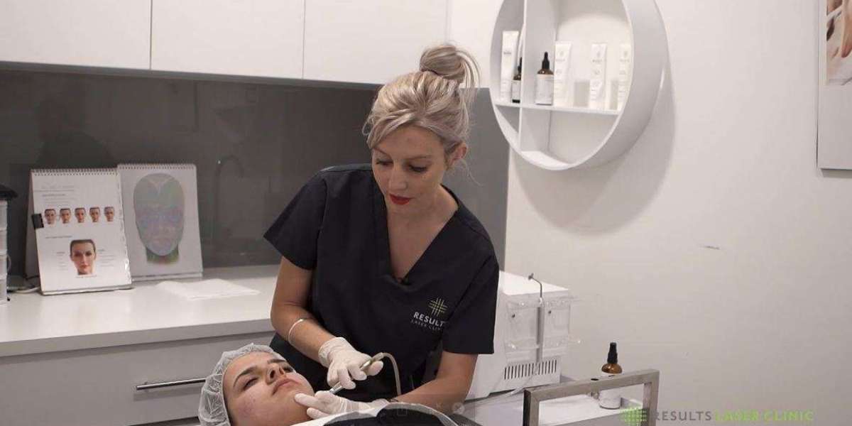 Sydney Laser Hair Removal: Debunking Common Myths and Misconceptions