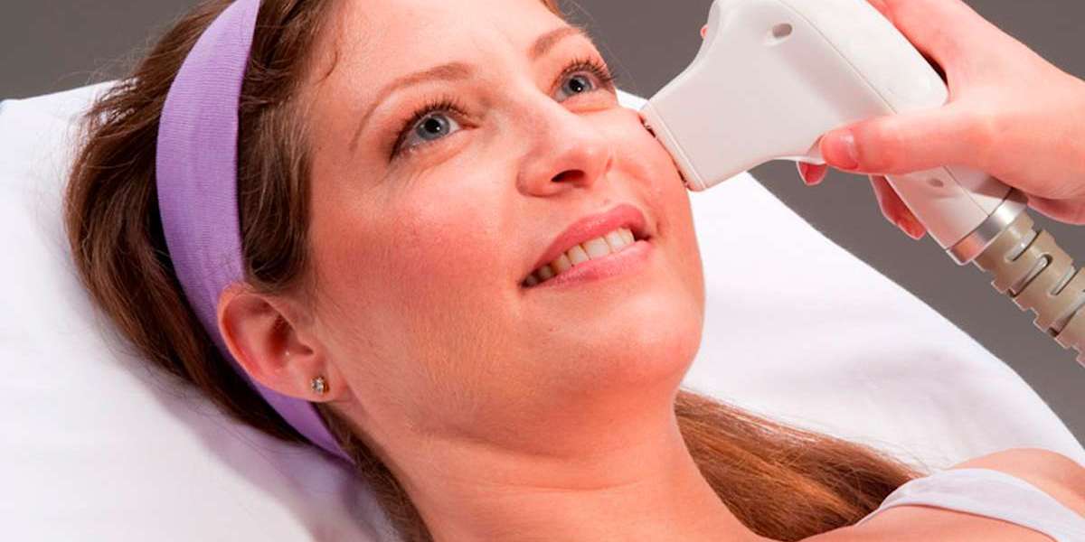 Using ultrasound, J Plasma Skin Tightening raises the under-chin and neck