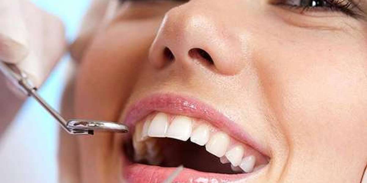 Revitalizing Smiles: The Comprehensive Guide to Dental Implants in Tampa