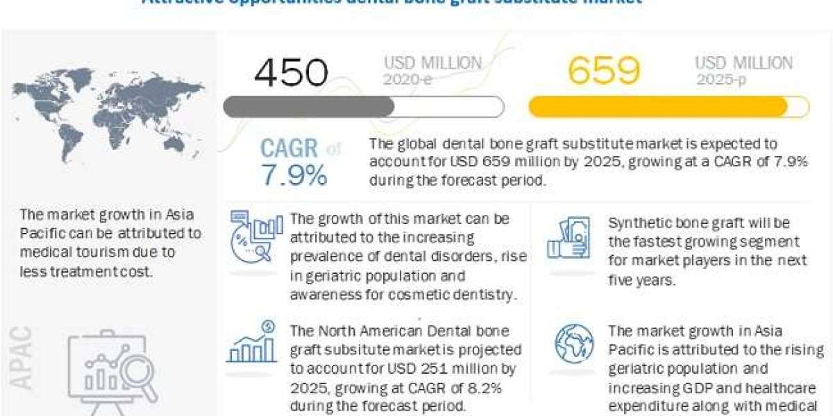 Dental Bone Graft Substitute Market Demands, Trends, Top Companies Analysis and Future Outlook