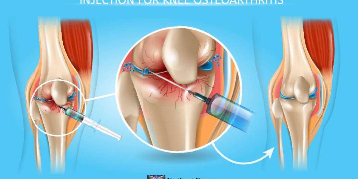 Hyaluronic Acid for Knees: A Natural Approach to Joint Health