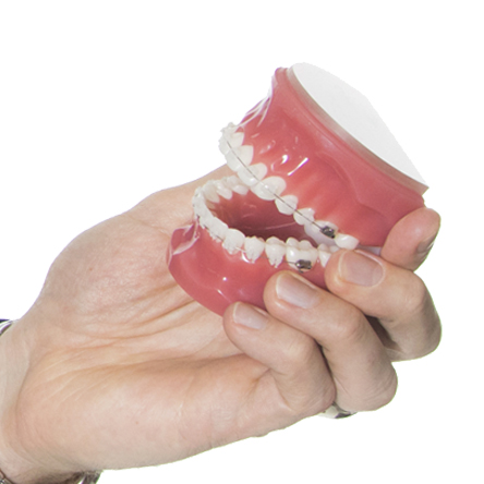 Moorhead Orthodontics | Moorhead Orthodontist | Detroit Lakes Orthodontics | Detroit Lakes Orthodontist | Orthodontics Moorhead | Orthodontist Moorhead - Ames Orthodontics