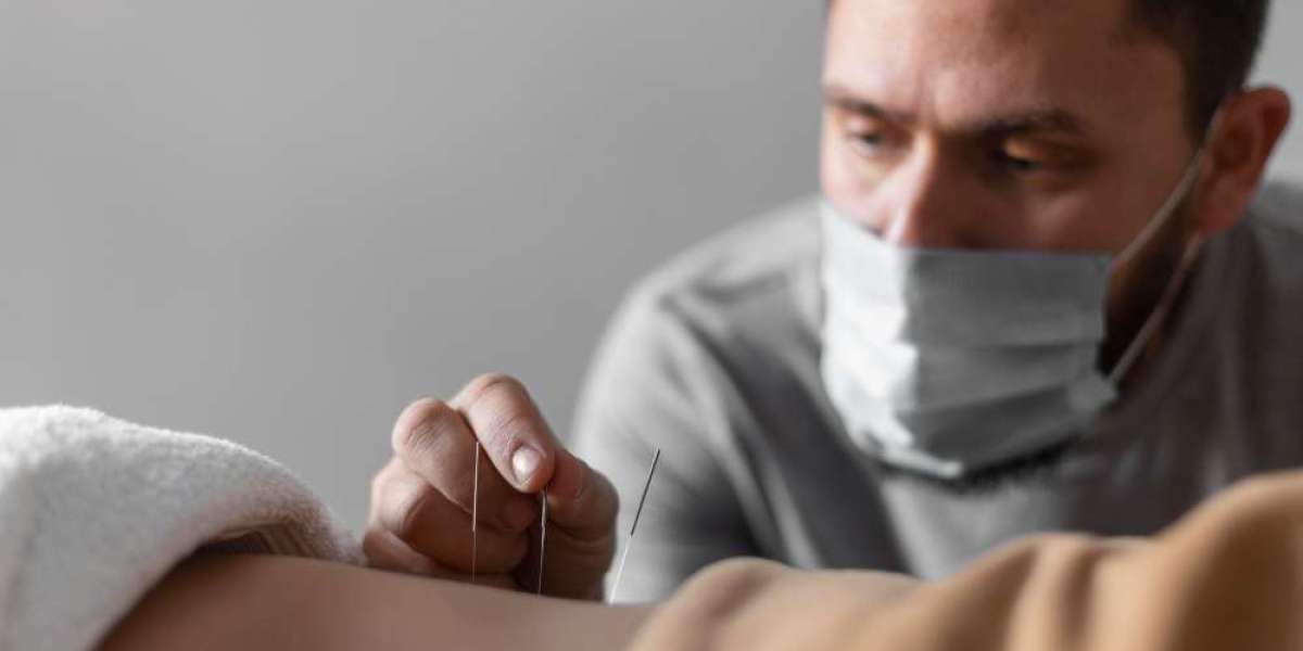 The Healing Benefits of Acupuncture In Morristown