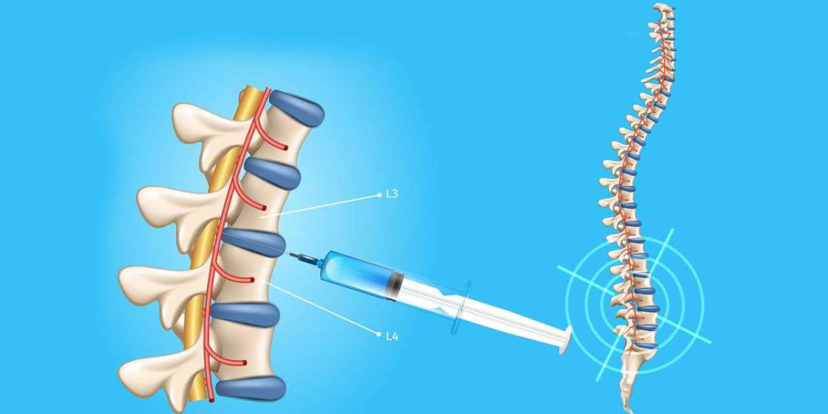 Spinal Needles Market: An Extensive Research on Expanding Industry Worth USD 0.44 Billion by 2030