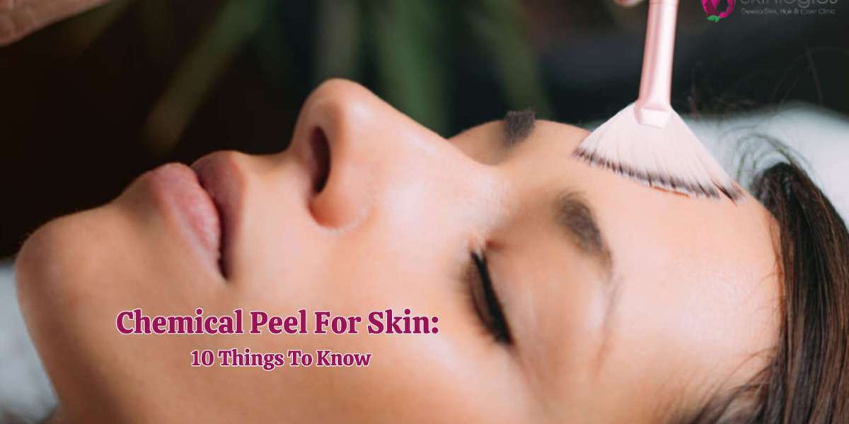Chemical Peel For Skin: 10 Things To Know