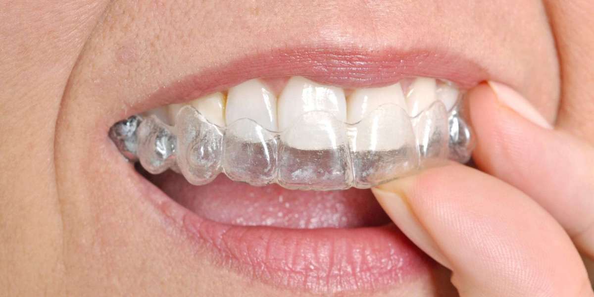 Discover the Benefits of Invisalign in Stamford, CT for a Perfectly Aligned Smile