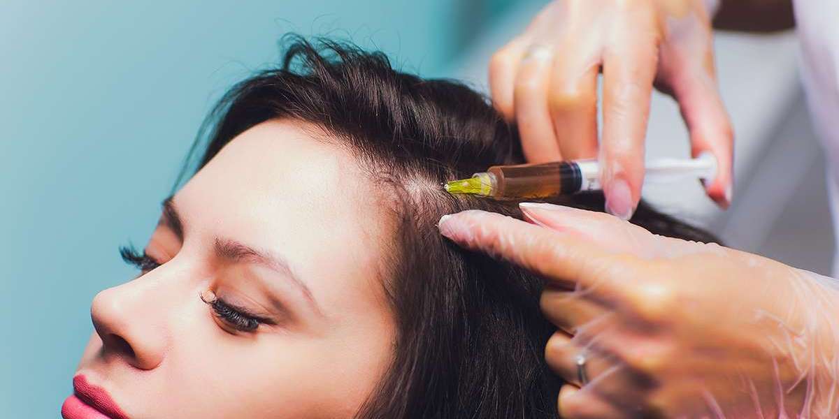 Enhance Your Tresses: PRP Hair Treatment Options in Riyadh