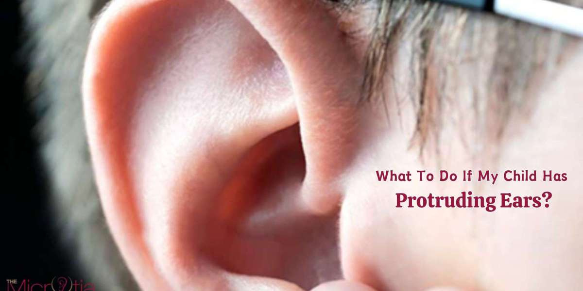 What To Do If My Child Has Protruding Ears?