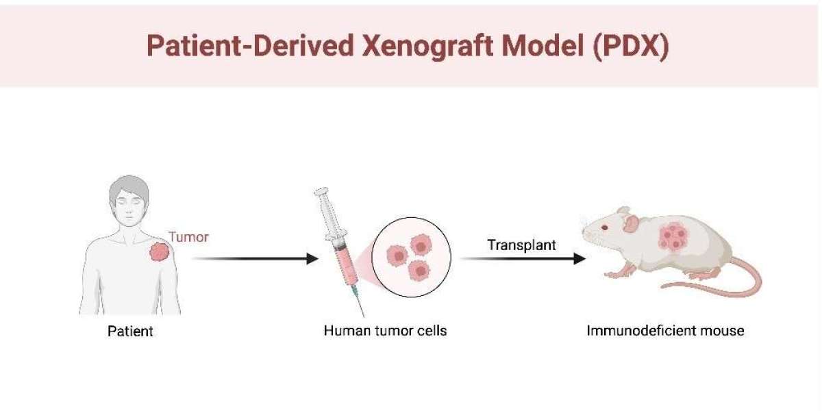 Beyond Traditional Models: Exploring the Advantages of Patient-Derived Xenografts
