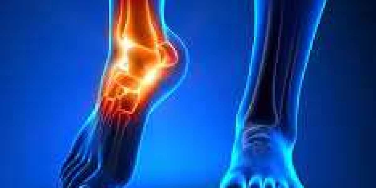 Guide to Chronic Ankle Pain: Causes, Diagnosis & Treatment