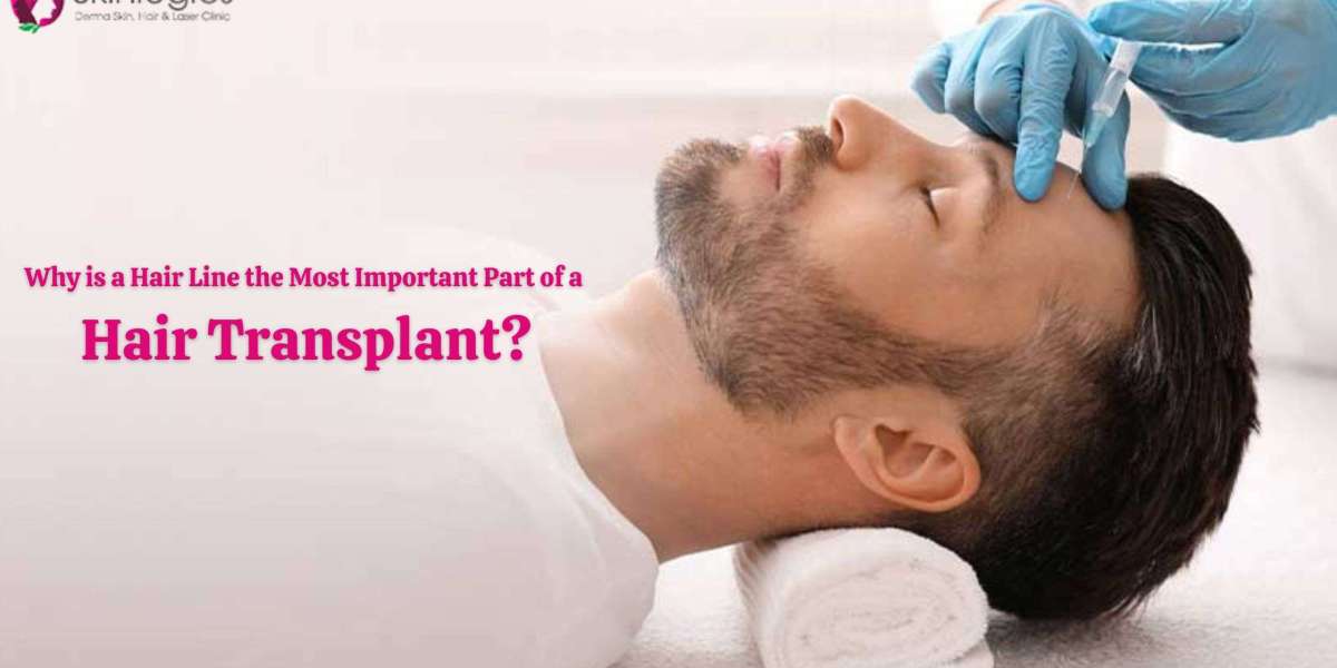 Why is a Hair Line the Most Important Part of a Hair Transplant?