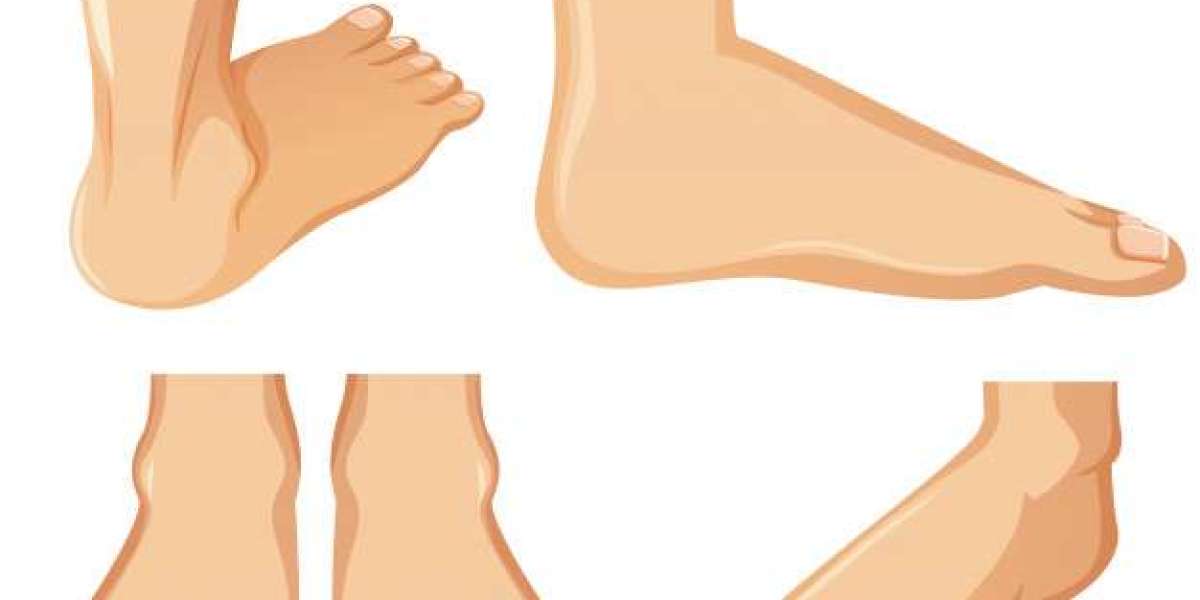 How do Podiatrist Foot Surgeons Remove Bunions?
