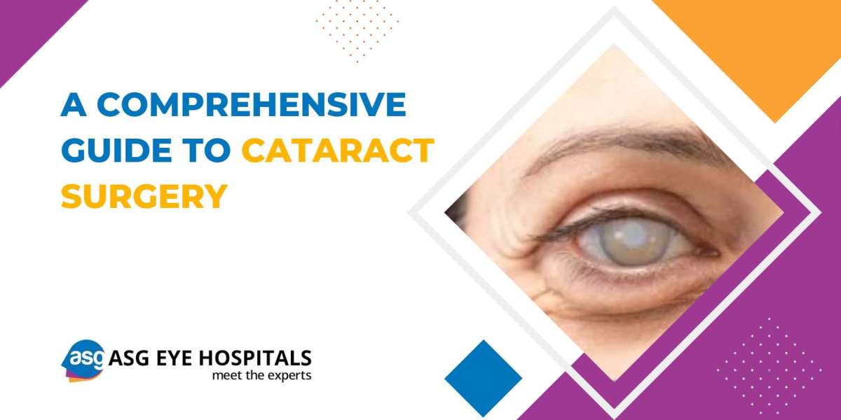 A Comprehensive Guide to Cataract Surgery at ASG Eye Hospital