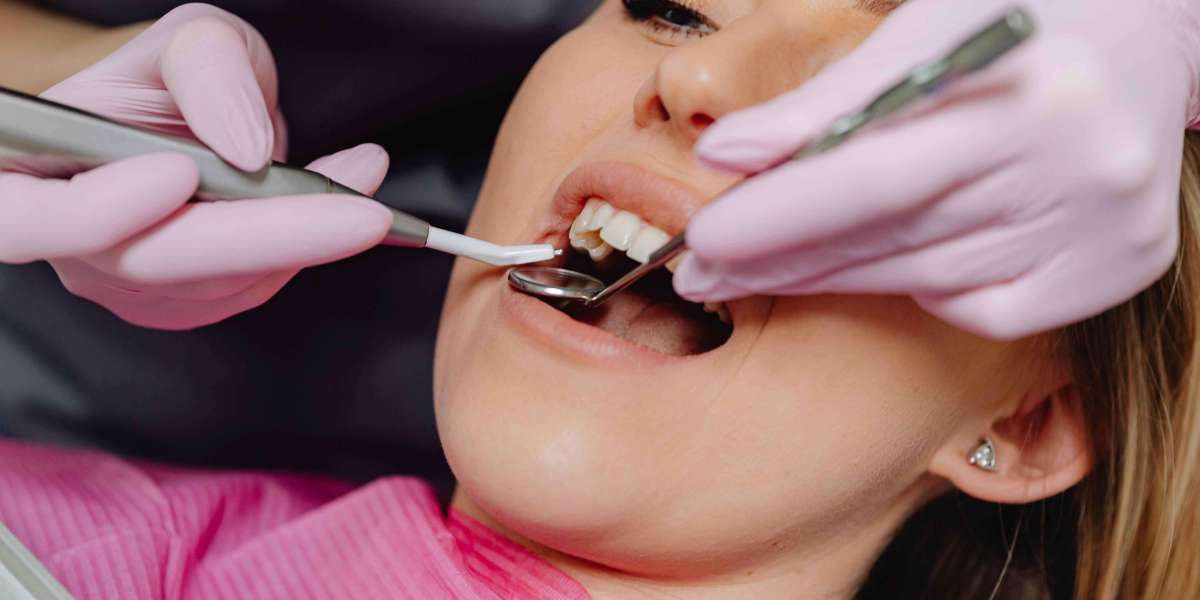 The Benefits of Dental Restoration