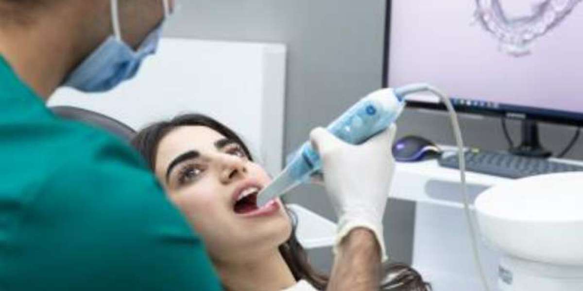 Best Teeth Capping in Chandigarh