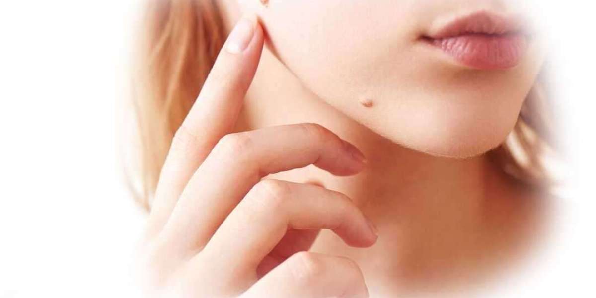 SkinFix Skin Tag Remover Reviews: Real Results, Is It Hoax Or Legit?
