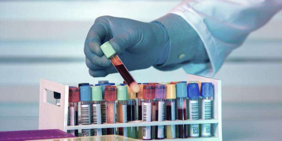 Biobanking Market Share, Trends, Industry Report and Forecast 2024-2032