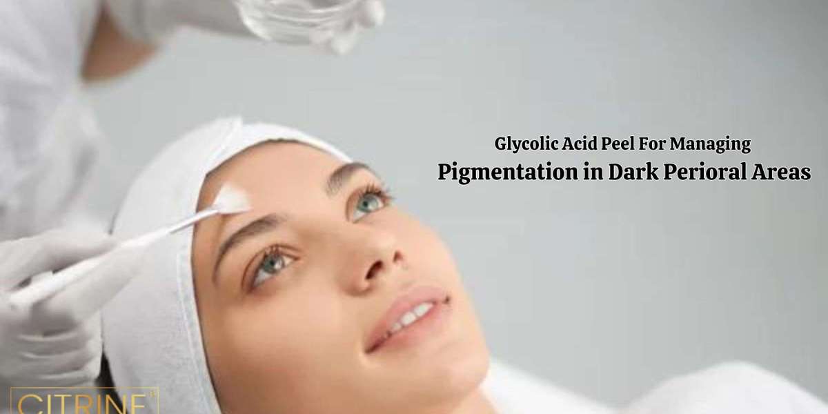 Glycolic Acid Peel For Managing Pigmentation In Dark Perioral Areas
