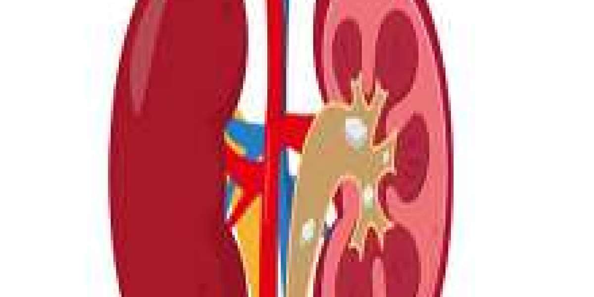 Nurturing Kidney Health: A Comprehensive Guide to Kidney Treatment in India