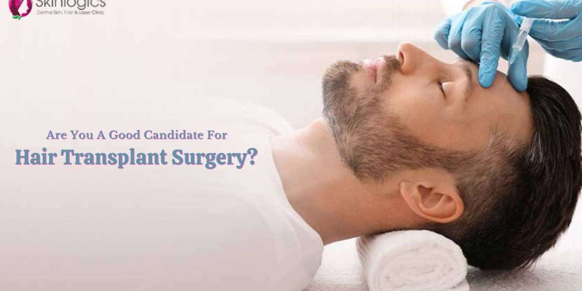 Are You A Good Candidate For Hair Transplant Surgery?