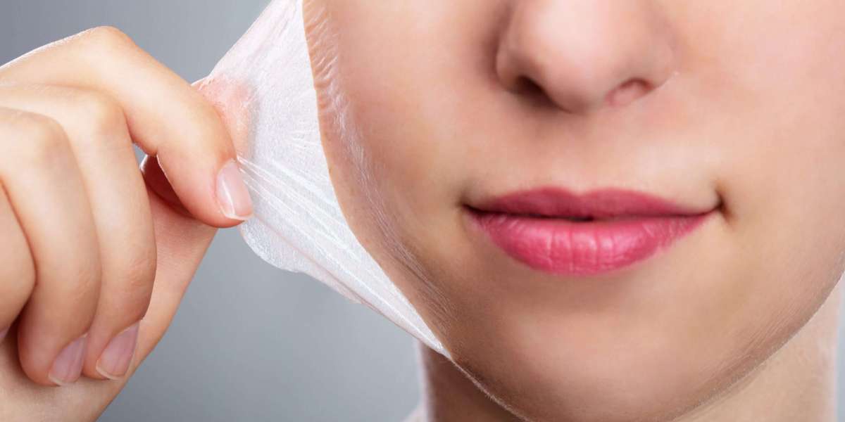 Unveiling the Secrets of Chemical Peeling in Dubai: What to Expect
